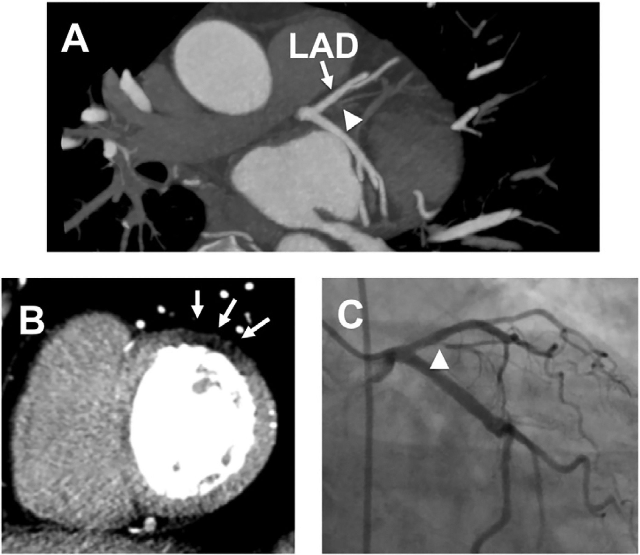 Figure 11: