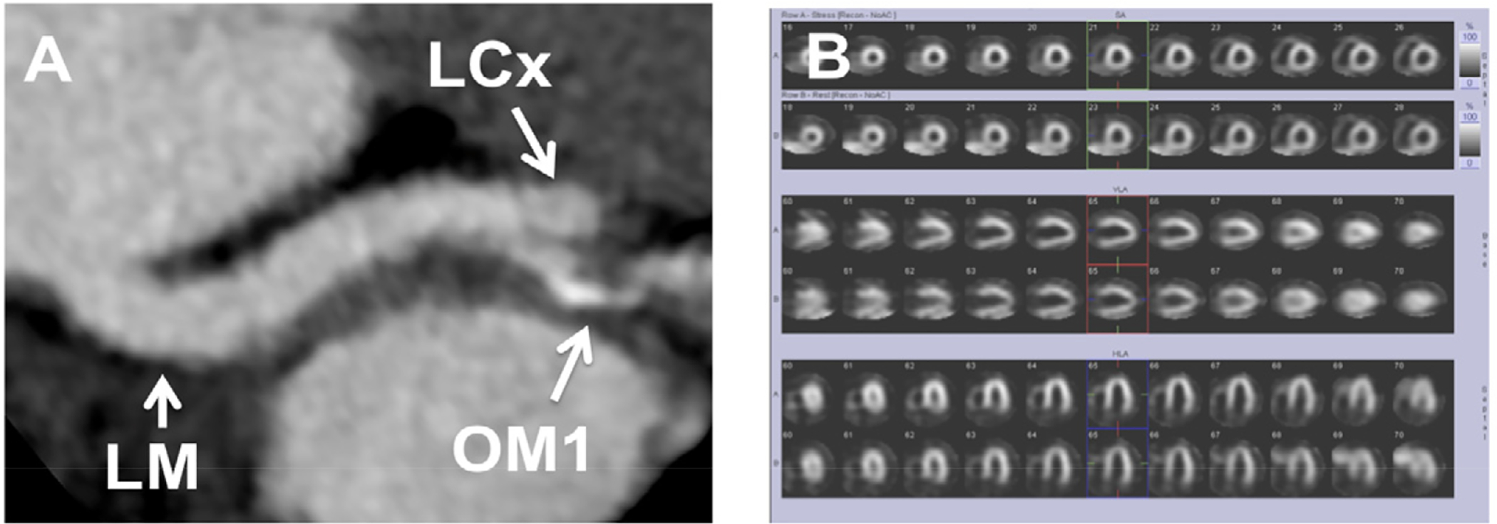 Figure 13: