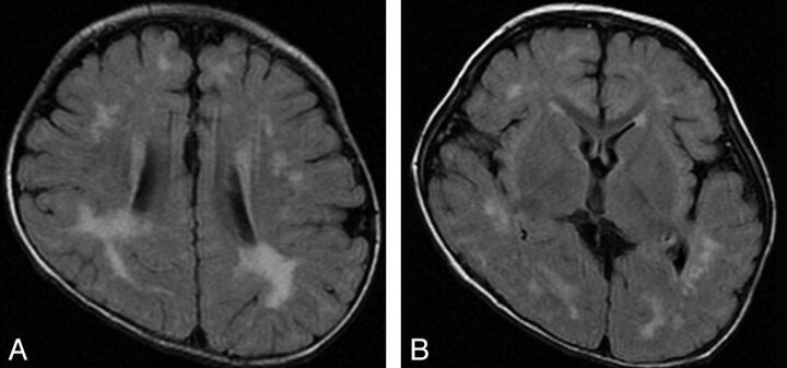 Fig 3.