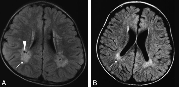 Fig 2.