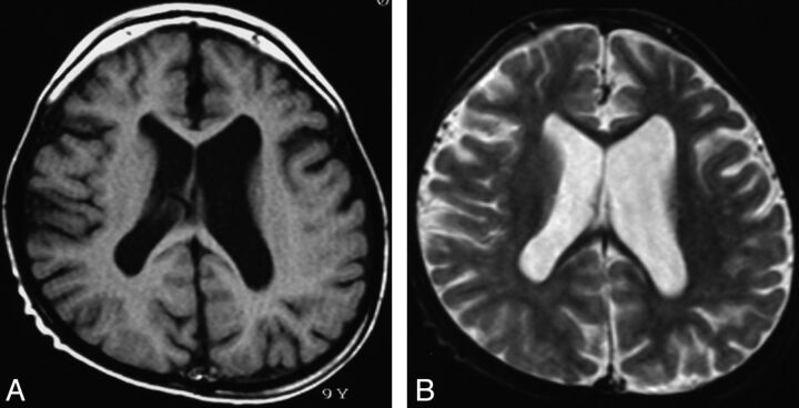 Fig 1.