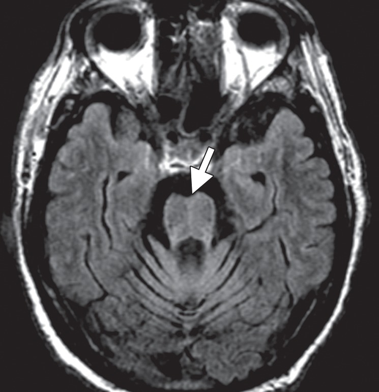 Figure 6b