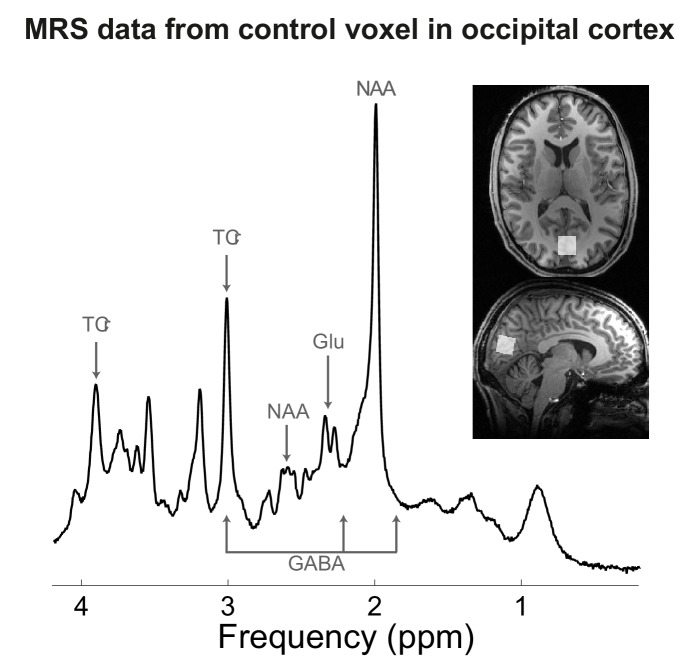 Figure 4—figure supplement 2.