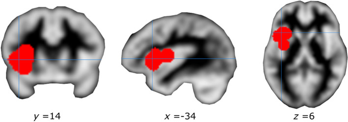 FIGURE 3