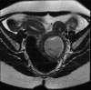 Figure 1a