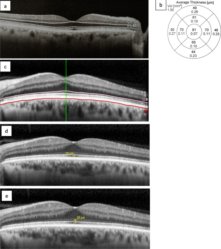 Fig. 2