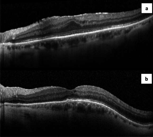 Fig. 3