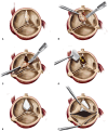 Figure 4