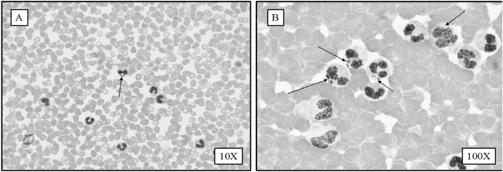 Fig. 1