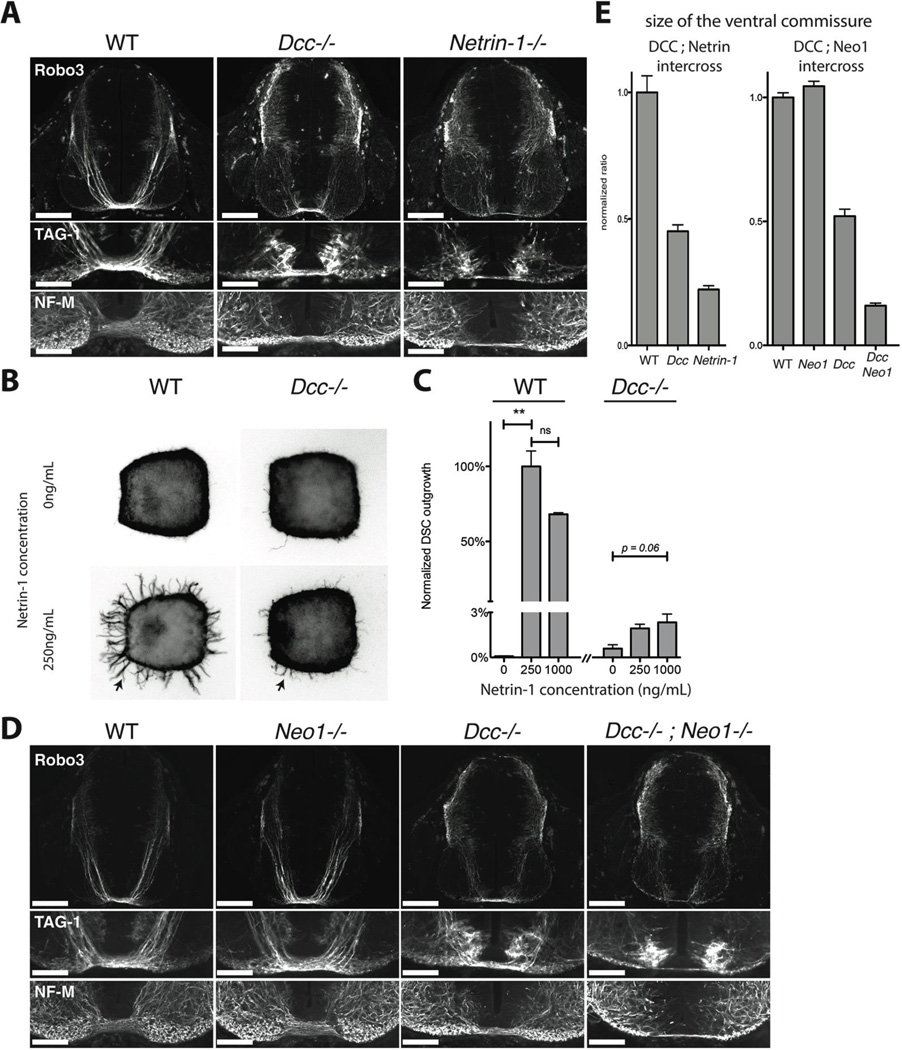 Structures of Netrin-1 Bound to two Receptors Provide Insight into its ...