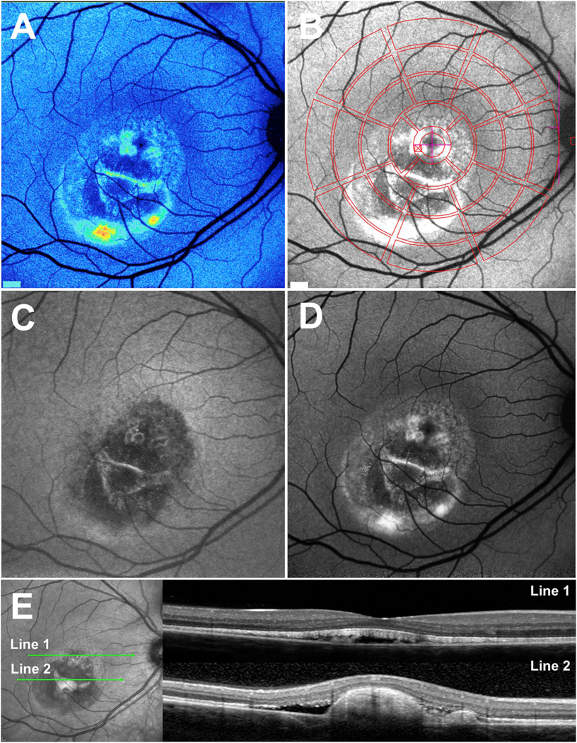 Fig. 3.