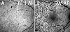 Fig. 10.