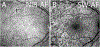 Fig. 11.