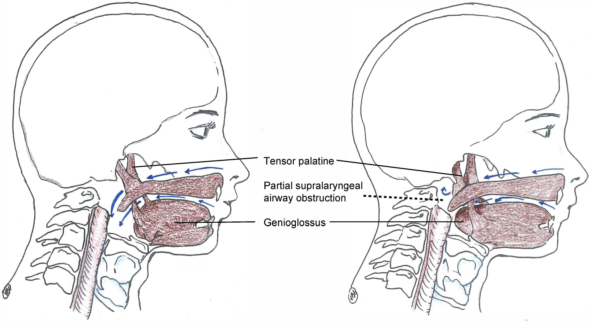 Figure 1: