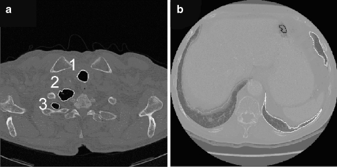 Fig. 1