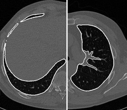 Fig. 11