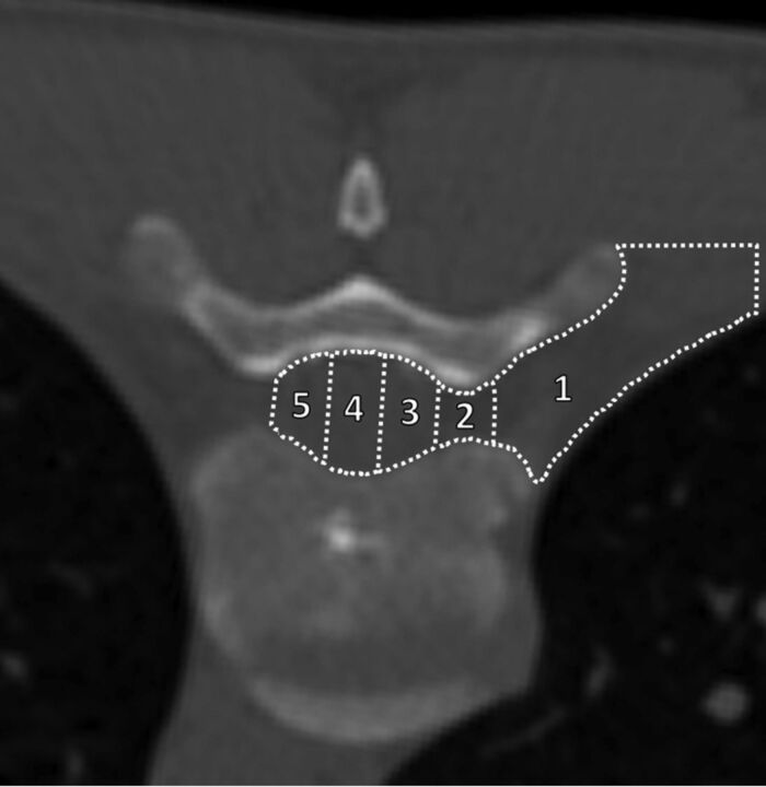 Fig 4.