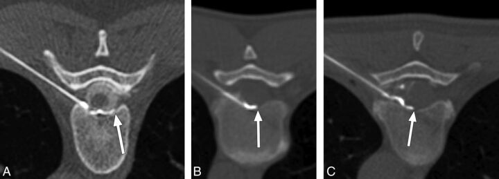 Fig 3.