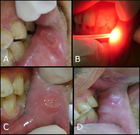 Figure 4