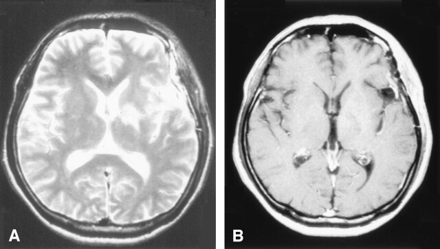 Fig 3.