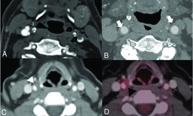 Fig 5.