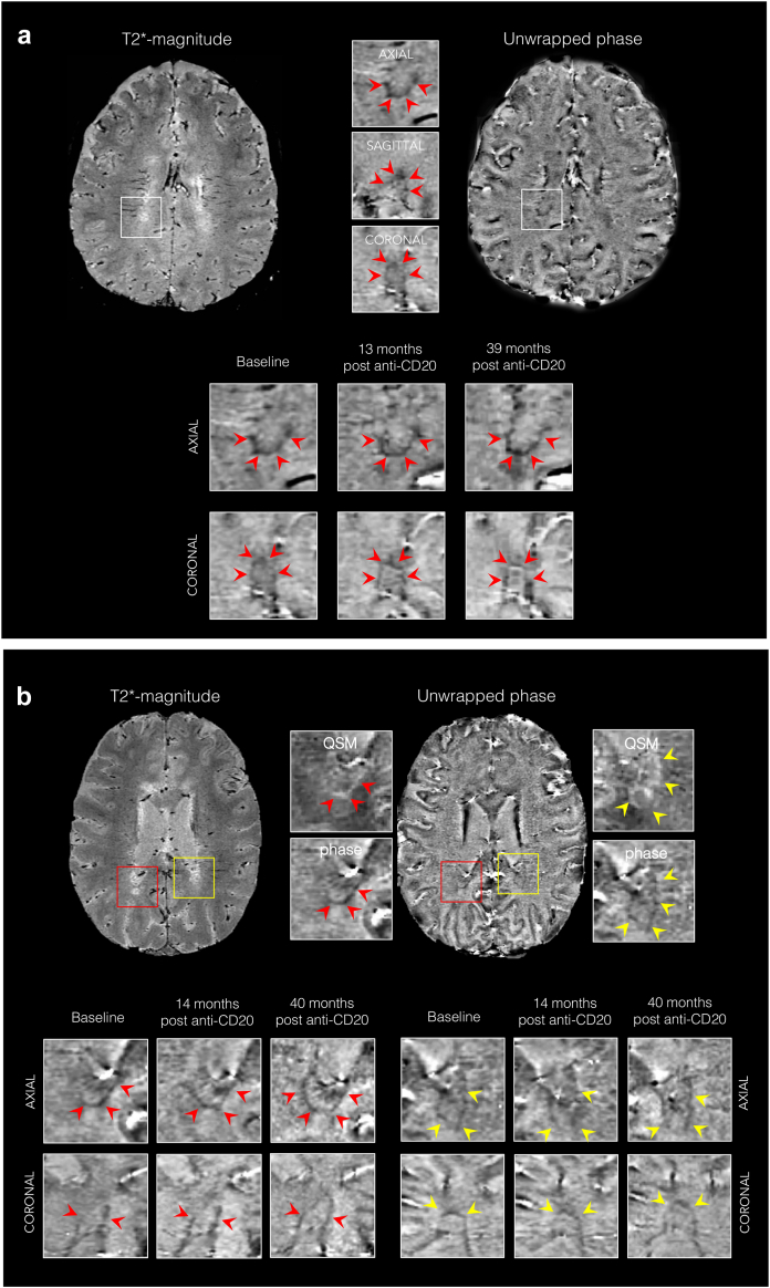 Fig. 4