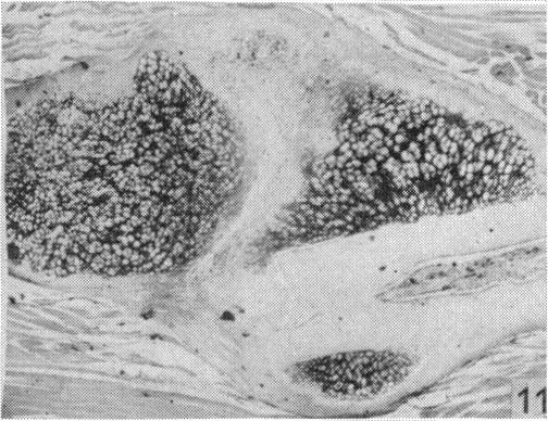 Fig. 11