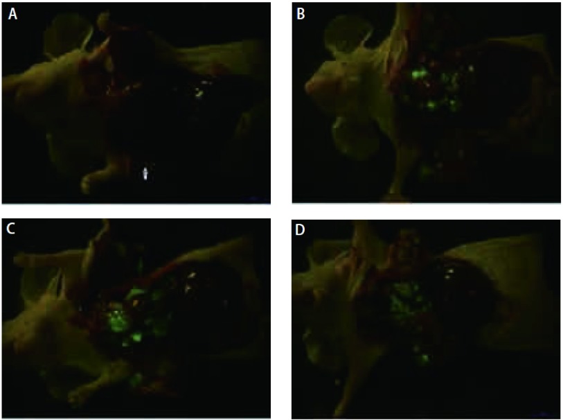 LLC-EGFP: Lewis lung cancer-enhanced green fluorescent protein.