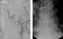 Figure 3. a, b