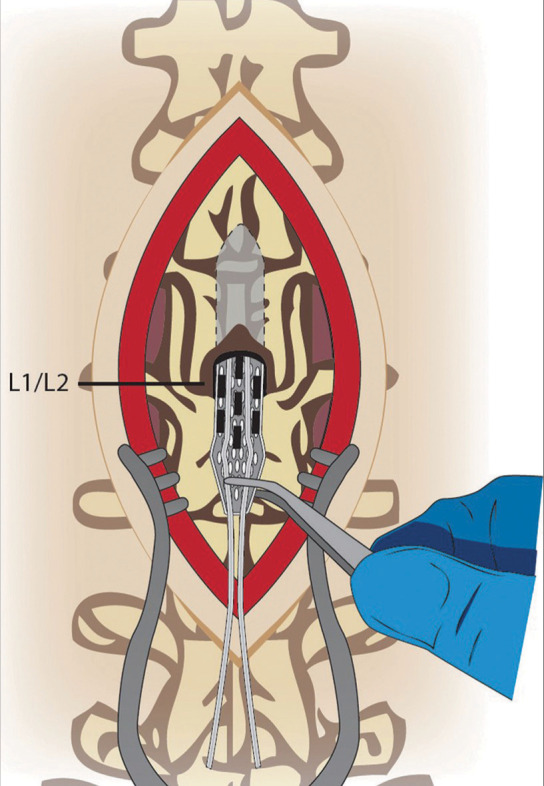 Figure 2: