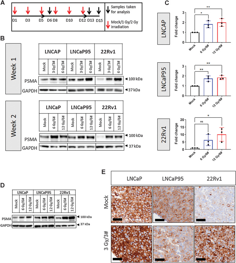 Figure 3. Repeated radiation induces PSMA protein expression in prostate cancer cells. LNCaP, LNCaP95, and 22Rv1 cell lines were subjected to cumulative radiation doses of 3, 6, or 12 Gy in 3 or 6 fractions (3 Gy/3#, 6 Gy/3#, 6 Gy/6#, and 12 Gy/6#). Samples were taken for analysis 24 hours after 3 or 6 fractions and 72 hours after 6 fractions (A). Western blot analysis evaluated PSMA protein change after 1 or 2 weeks of fractionated radiation (B). Densitometric analysis (n = 3) of blots showed significant increases in PSMA protein across all lines at 12 Gy doses delivered in 6 fractions (LNCaP, P = 0.007; LNCaP95, P = 0.003; 22Rv1, P = 0.017) and in LNCaP95 and LNCaP cells at 6 Gy doses delivered in 6 fractions (LNCaP, P = 0.017; LNCaP95, P = 0.007; C). PSMA upregulation was sustained for 72 hours after the final dose of ionizing radiation of either 6 Gy/6# or 12 Gy/6# (D15) across all cell lines (D). FFPE cell pellets treated with 3 Gy/3# underwent IHC analysis for cytoplasmic and membranous PSMA; representative images are shown for each cell line (E). PSMA protein change in treatment versus mock groups was subjected to Student t tests to detect significance. Mean and standard deviation are shown. Normality was assumed. Statistical significance was considered at P < 0.05 (*, P < 0.05; **, P < 0.01; ***, P < 0.001; ****, P < 0.0001).