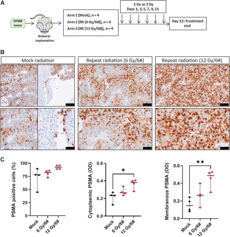 Figure 5. Repeat radiation induces significant increases in PSMA protein expression and reduces the heterogeneity of PSMA expression in PDX tumors. CP286 PDX tumor pieces were implanted into NSG mice and grown to 400 mm3 before randomization and treatment with either mock or repeated radiation (RR); RR included 6 repeated doses of 1 Gy (cumulative 6 Gy) or 2 Gy (cumulative 12 Gy) of ionizing external beam irradiation (A). Tumor samples were subsequently taken on day 12 and analyzed for PSMA expression through IHC analysis. Four tumors per treatment group were fixed and underwent PSMA IHC. Representative images of mock or irradiated tumors at 10× and 20× are displayed. Black scale bars represent 100 μm (top row) and 50 μm (bottom row; B). As CP286 mock-treated tumors were heterogeneous for PSMA expression, an example of PSMA-positive and -negative tumor is shown. IHC of tumor cores was scanned and analyzed by HALO image analysis software. Percentage cells positive for PSMA were compared between treatment groups (C). Average optical density (OD), a read-out for intensity, was also investigated for changes in cytoplasmic and membranous PSMA (C). Changes in various measures of PSMA in treatment versus vehicle groups were subjected to Student t tests to detect significance. Median and 95% confidence intervals are shown. Normality was assumed. Statistical significance was considered at P < 0.05 (*, P < 0.05; **, P < 0.01; ***, P < 0.001; ****, P < 0.0001).