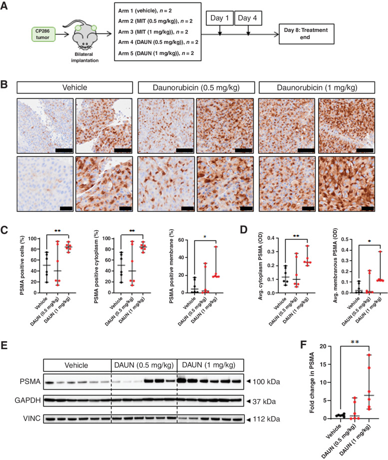 Figure 4. Topoisomerase-2 inhibition induces significant increases in PSMA protein expression and reduces the heterogeneity of PSMA expression in PDX tumors. CP286 PDX tumor pieces were implanted into NSG mice and grown to 400 mm3 before randomization and treatment with either vehicle (PBS), or 0.5 or 1 mg/kg of daunorubicin (DAUN) or mitoxantrone (MIT; Supplementary Fig. S5; A). Tumor samples were subsequently taken on day 8 and analyzed for PSMA expression through IHC and western blot analysis. Three independent tumor cores from each treatment group were fixed and underwent PSMA IHC. Representative images of daunorubicin-treated tumors at 10× and 20× are displayed. Black scale bars, 100 μm (top row) and 40 μm (bottom row; B). IHC of tumor cores was scanned and analyzed by HALO image analysis software. Percentage cells, percentage cytoplasmic, and percentage membranous (C) positivity for PSMA were compared between treatment groups. Average optical density (OD), a read-out for intensity, was also investigated for changes in cytoplasmic and membranous PSMA (D). Lysates of tumor cores were also analyzed by western blot (E), and densitometry (F) was undertaken to measure change in PSMA. PSMA was normalized to the housekeeping gene vinculin (VINC). The highest treatment group displayed significantly higher PSMA protein in western blot (P = 0.004). Changes in various measures of PSMA in treatment versus vehicle groups were subjected to Student t tests to detect significance. Median and 95% confidence intervals are shown. Normality was assumed. Statistical significance was considered at P < 0.05 (*, P < 0.05; **, P < 0.01; ***, P < 0.001; ****, P < 0.0001).