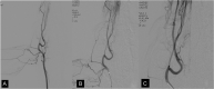 Fig 1.