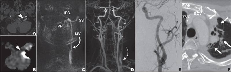 Fig. 2—