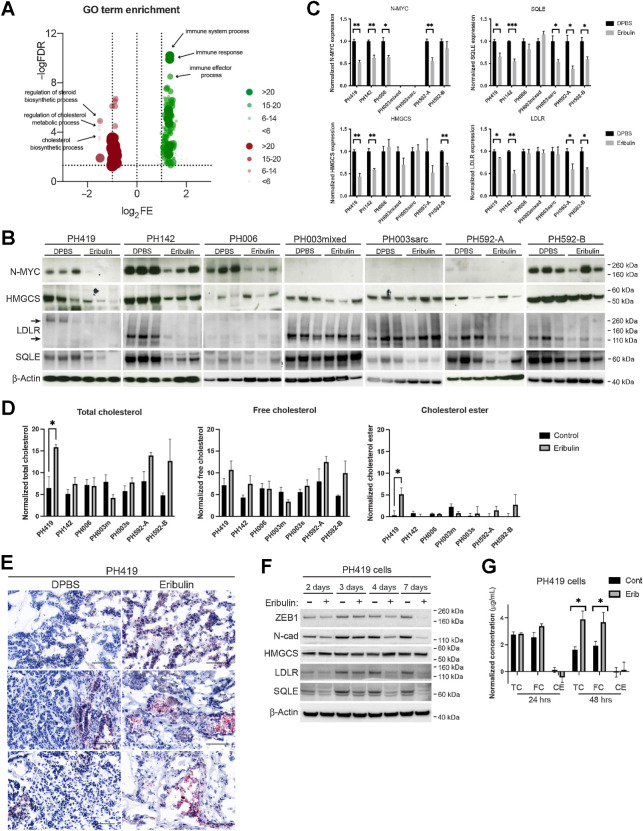 Figure 5. The mevalonate pathway was downregulated following eribulin treatment of OCS cells and tumors as a result of increased cellular cholesterol. A, Analysis of GO terms enriched for downregulated (left) and upregulated (right) differentially expressed genes. Circle sizes indicate differentially expressed genes present in each GO term. Differentially expressed genes are listed in Supplementary Tables S20–S23. B, Expression of N-MYC, HMGCS, SQLE, and LDLR in tumors from each OCS PDX model after a single dose of vehicle (DPBS) or eribulin was determined by Western blot analysis. β-Actin was used as a loading control. C, Quantification of expression data in B. D, Quantification of total cholesterol, free cholesterol, and cholesterol ester in tumors from each OCS PDX model after a single dose of vehicle (DPBS) or eribulin. E, Representative images of Oil Red O staining in PH419 tumors following a single dose of vehicle (DPBS) or eribulin. Scale bar, 100 μm. F, Expression of the mesenchymal markers ZEB1 and N-cadherin, as well as the MVA pathway proteins HMGCS, SQLE, and LDLR, in PH419 cells exposed to 15 nmol/L of eribulin or DMSO control for the indicated time points was determined by Western blot analysis. β-Actin was used as a loading control. G, Quantification of total cholesterol, free cholesterol, and cholesterol ester in PH419 cells exposed to 15 nmol/L of eribulin or DMSO control for the indicated time points. Bar graphs represent the mean and SE across independent experimental repeats (n = 3). *, P < 0.05; **, P < 0.01; ***, P < 0.001. TC, total cholesterol; FC, free cholesterol; CE, cholesterol ester.