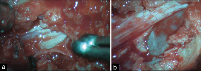 Figure 2: