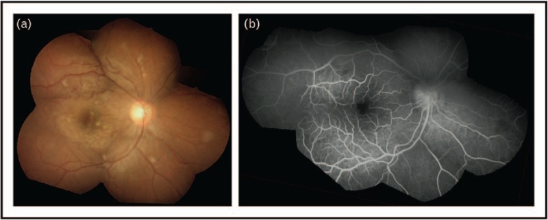 FIGURE 2