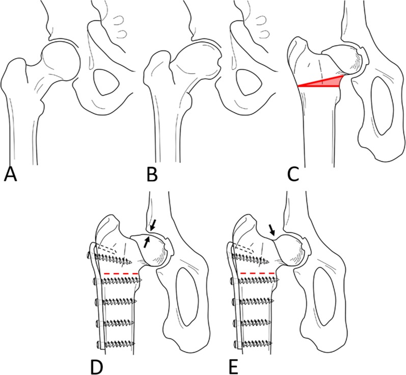 Fig. 1 A-E