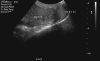 Fig. 1a