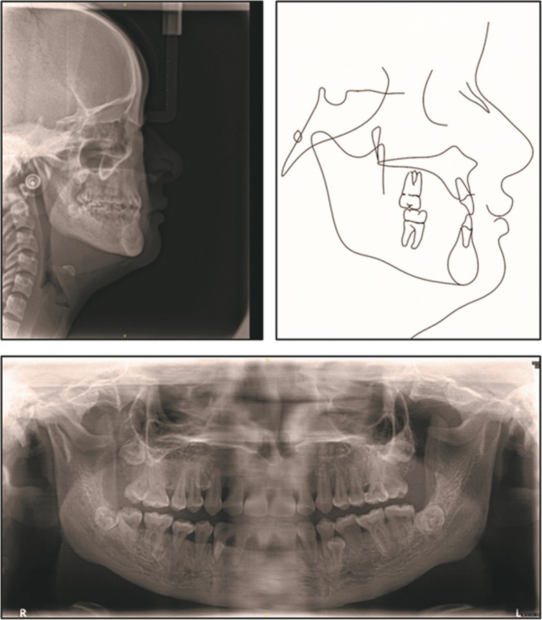 Fig. 5