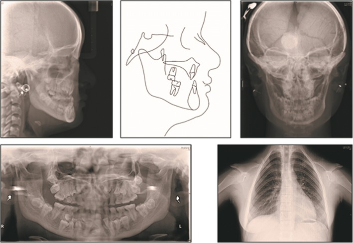 Fig. 2