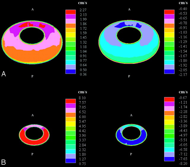 Fig 5.