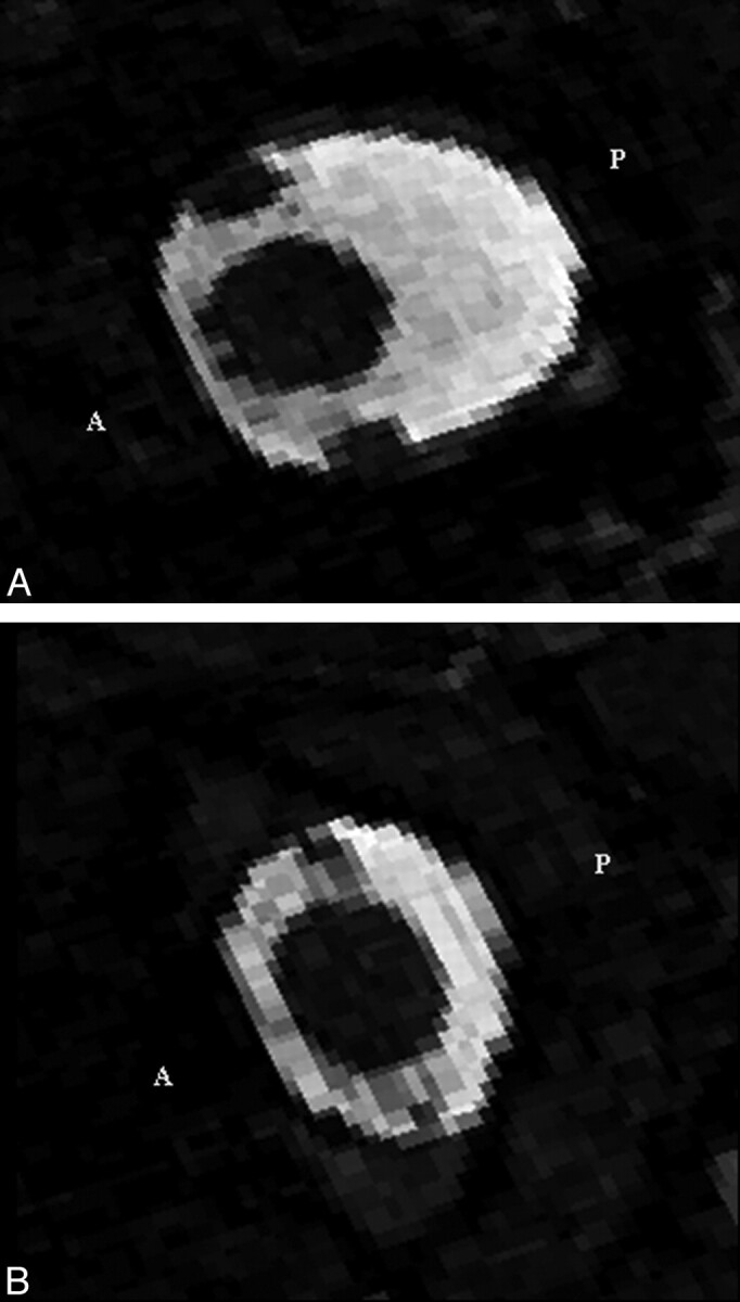 Fig 3.