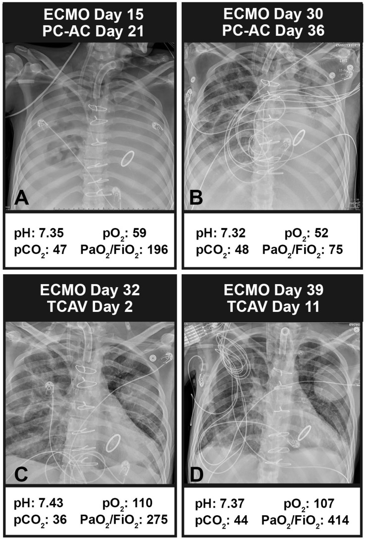 FIGURE 13