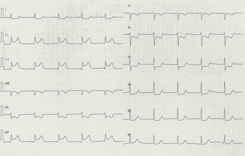 Fig. 2