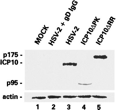 FIG. 11.