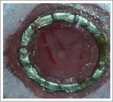 graphic file with name kinv-05-01-1125562-i005.gif