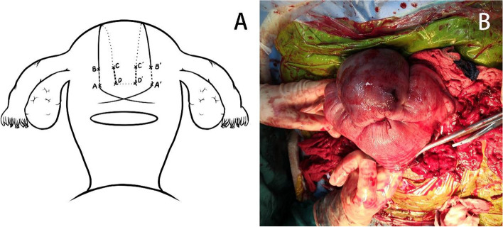 Fig. 1
