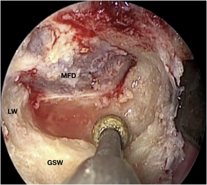 Fig. 3